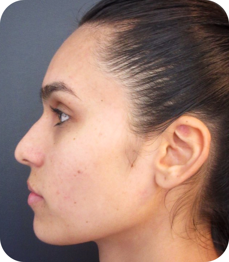 ad_Facial_a